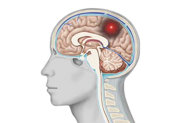 brain brain