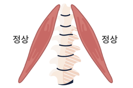 spine-muscle1 spine-muscle1